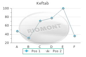 buy 375mg keftab with amex