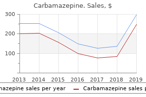 order carbamazepine with american express