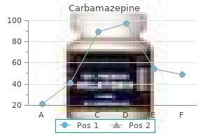 purchase generic carbamazepine on-line