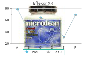 order effexor xr 150 mg overnight delivery