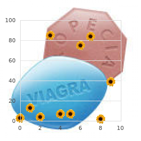 Congenital spherocytic anemia