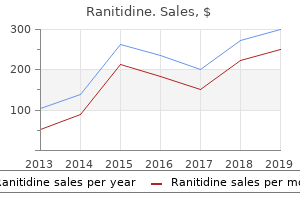 ranitidine 150 mg fast delivery