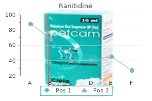 order ranitidine on line amex