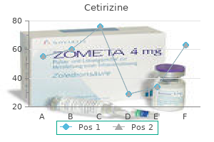 order cetirizine 10 mg with mastercard