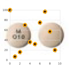 Chromosome 9, partial monosomy 9p