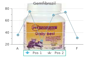 best 300mg gemfibrozil