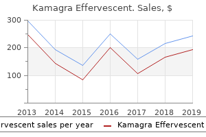 cheap kamagra effervescent 100mg fast delivery