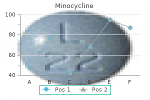 best buy for minocycline