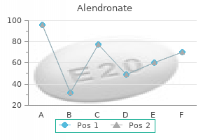 buy discount alendronate 35mg online