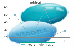 buy 250mg terbinafine amex