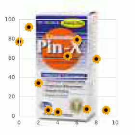 Mondini dysplasia