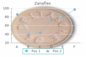 order zanaflex 2 mg with mastercard